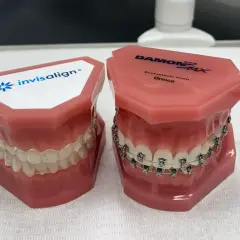 Dwa modele szczęk: jeden z przezroczystymi nakładkami Invisalign, drugi z tradycyjnym aparatem ortodontycznym.