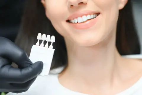 Ile kosztuje wybielenie zębów u dentysty? Sprawdź ceny i metody