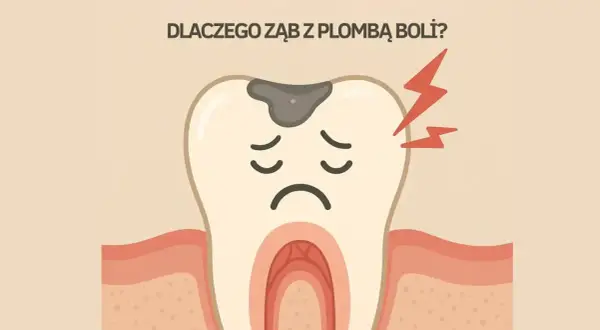 Smutny ząb z plombą i czerwonymi błyskawicami bólu. Dlaczego ząb z plombą boli?