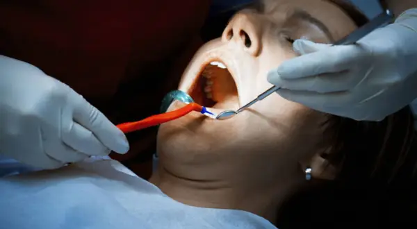Dentysta bada jamę ustną pacjentki. Czy antybiotyk pomoże na ropień zęba?