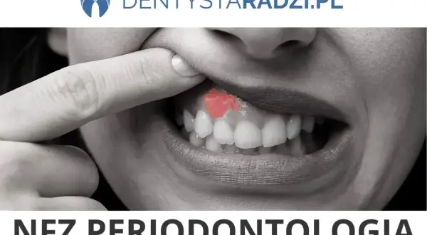 Palec wskazuje na zaczerwienione dziąsło, objaw parodontozy. NFZ periodontologia.
