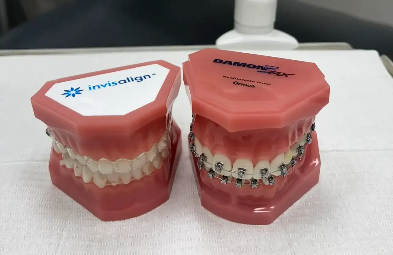 Invisalign w Olsztynie - cena, leczenie i aparat stały