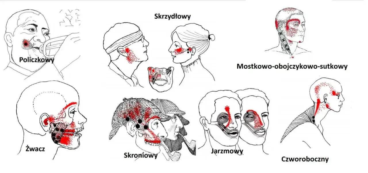 Uderzenie w szczękę - kiedy to stłuczenie, a kiedy złamanie?