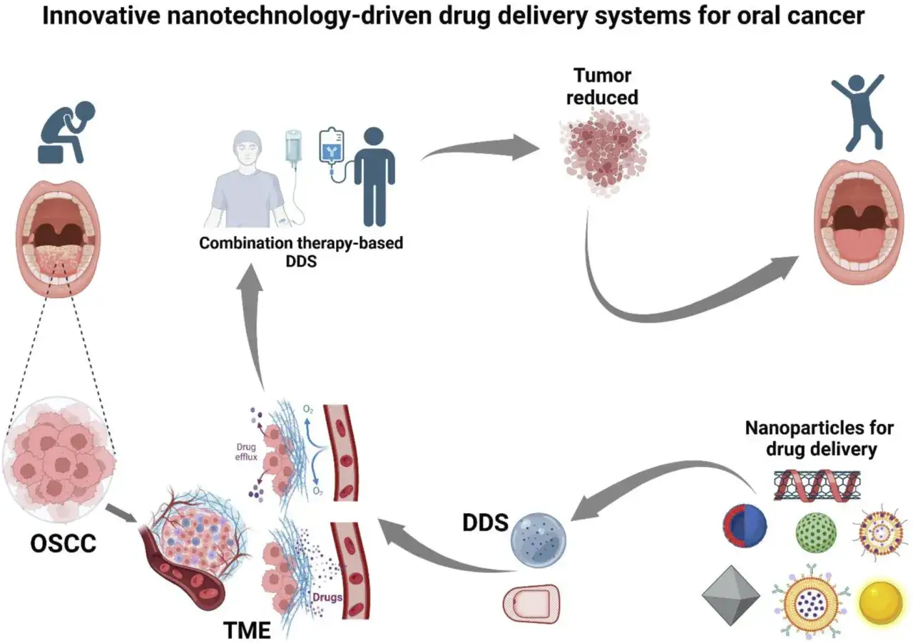 Schemat przedstawia leczenie raka jamy ustnej za pomocą nanotechnologii. Połączenie terapii i systemów dostarczania leków (DDS) redukuje guz, przywracając zdrowie.