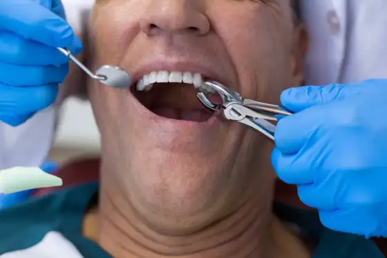 Ból po wyrwaniu zęba - co jest normą, a kiedy do dentysty?