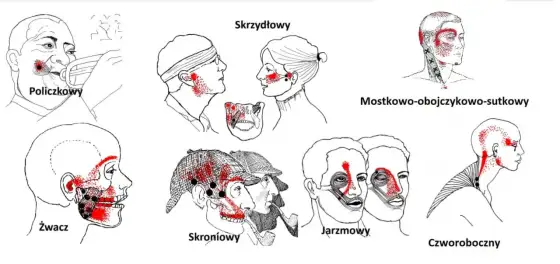 Uderzenie w szczękę - kiedy to stłuczenie, a kiedy złamanie?