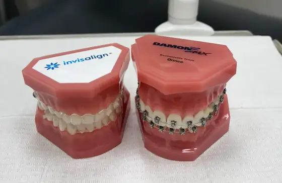Invisalign w Olsztynie - cena, leczenie i aparat stały